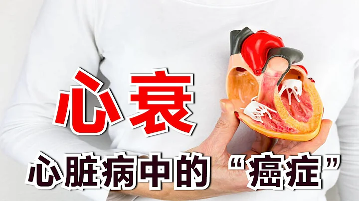 心衰，心臟病中的“癌症”！有一種心衰最容易被忽視，美國最多！ - 天天要聞