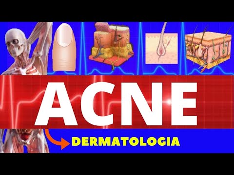 Vídeo: Acne Conglobata: Sintomas, Causas, Tratamento E Muito Mais