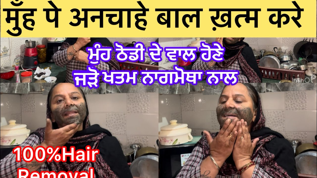 Hair removal#ਨਾਗਰਮੋਥਾ ਤੇ ਆਹ ਚੀਜ਼ਾਂ ਲਾਊਣ ਨਾਲ ਮੁੰਹ ਦੇ ਵਾਲ ਹਮੇਸ਼ਾ ਲਈ ਖਤਮ#अनचाहेबाल ऐसे ख़त्म करें 