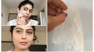 Remove Unwanted Facial Hair, Blackheads & Whiteheads at Home