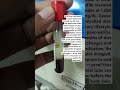 #medicalscience #pathology #bloodtest #bmlt #dmlt #health #fatloss #lipidprofile #sedentarylifestyle