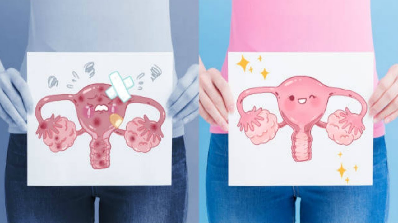 How to Unblock Your Fallopian Tubes Naturally Part 2 YouTube