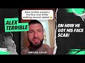 Alex Terrible on how he got his face scar!