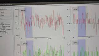 Details IMU Sensor Noise - Gravity Removed News