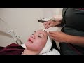 The clinic beautylosophy lombok  treatment laser venus versa acne