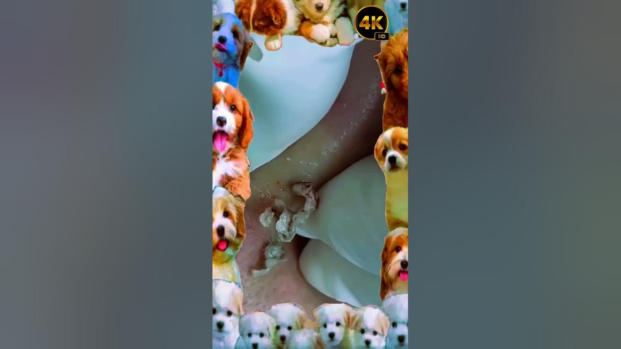 Blackheads Removal Acne Treatment and Very Satisfying Satisfying Pimple pop 2025 blackheads