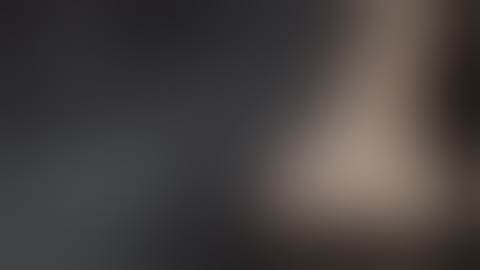 FHL Implant System With Tension-Slide Technique