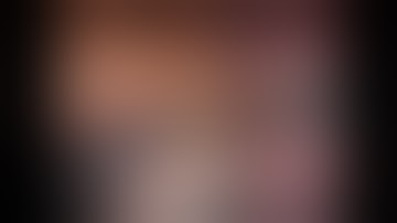 Fissureless Robotic Left Upper Lobectomy with LIMA; step-by-step narration