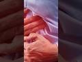 اشهر اعراض القولون العصبي التغذية الصحية القولون العصبي احمد بدر تغذيه علاجيه القولون