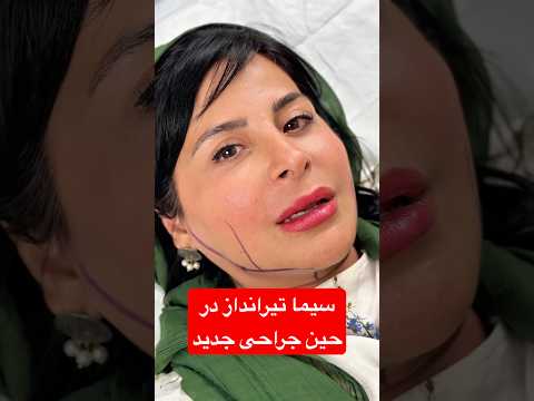 راز زیبایی سیما تیرانداز