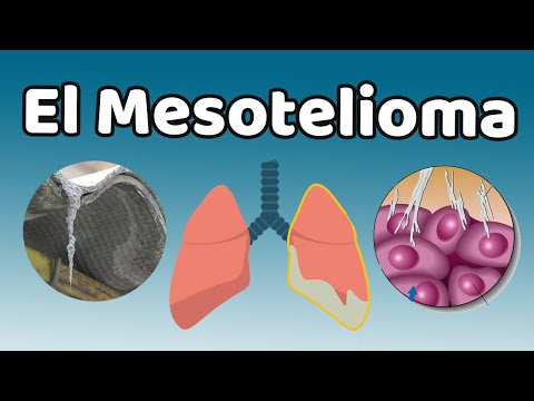 EL MESOTELIOMA, Causas, signos y síntomas, diagnóstico y tratamiento