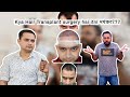 Reality of 3 month hair transplant result  low cost hair transplant in delhi