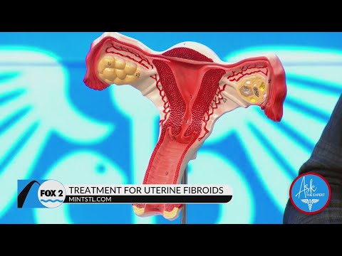 Find Uterine Fibroid Relief at Midwest Institute for Non-Surgical Therapy