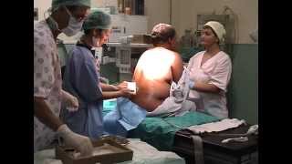 Caesarean section evidence-based surgical technique