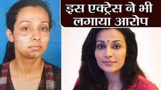Stree Actress Flora Saini opens up on getting assaulted by Producer Gaurang Doshi | वनइंडिया हिंदी