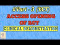 Access opening of RCT
(RCT PART- 3)