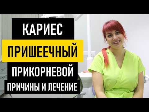 Пришеечный кариес как лечить в домашних условиях