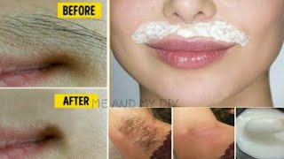 Using this method to remove unwanted hair|Remove facial hair at home|Now no more shave use this