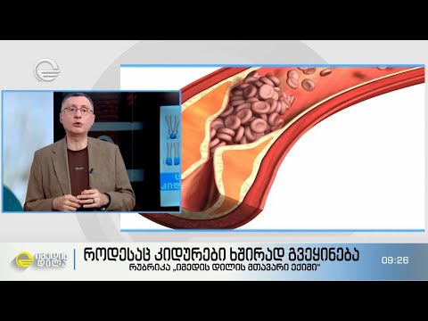 როგორ უნდა მოვიქცეთ იმ შემთხვევაში თუ ხელები და ფეხები ხშირად გვეყინება