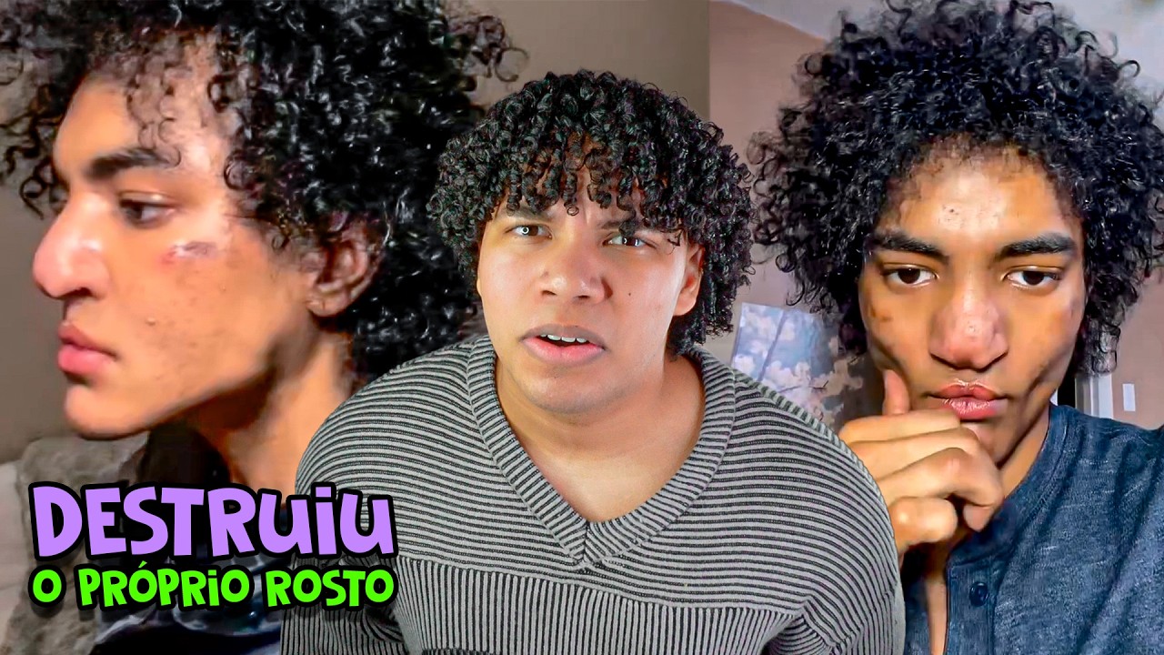 TikToker destrói o rosto fazendo Looksmaxxing