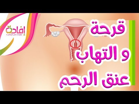 فيديو: هل يمكن علاج ديدان الكلاب بالعلاج بدون وصفة طبية؟