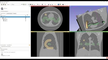 Create DICOM files from CT volume and segmentation