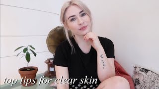 MY TOP TIPS FOR CLEARING ACNE PRONE SKIN | ad