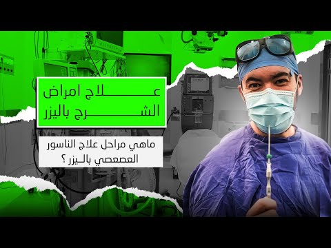 علاج الناسور العصعصي بالليزر