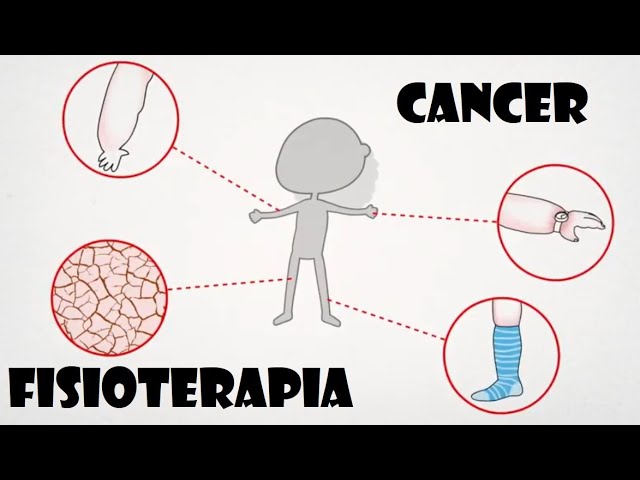 La magnetoterapia: indicaciones terapéuticas - Asepeyo salud