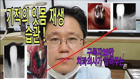 녹은 잇몸 팍~ 살리는 기적의 습관은?