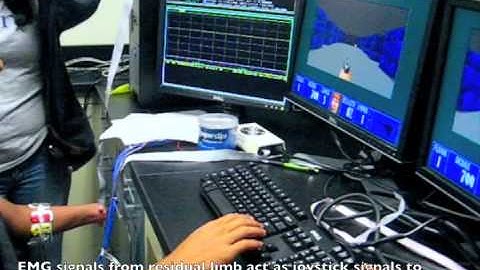 Amputee Plays Video Game Using EMG