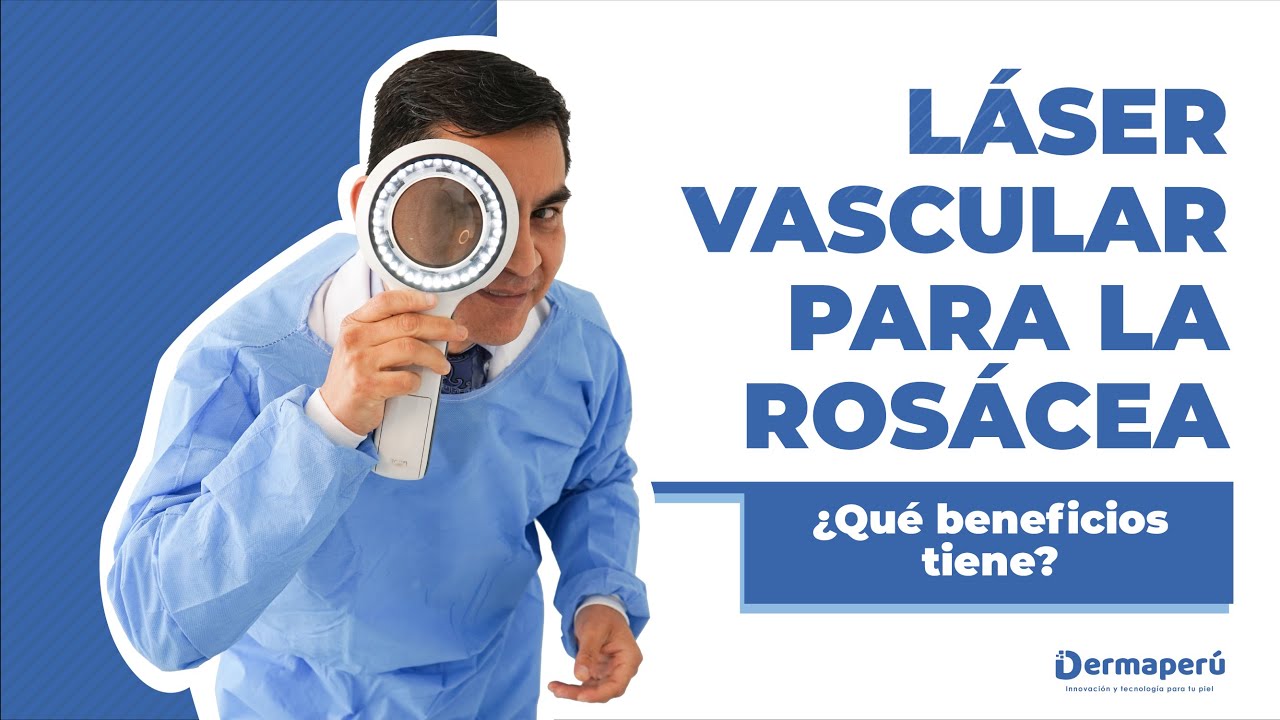 Vascular Rocacea LÁSER VASCULAR: rosácea controlada desde la primera sesión - YouTube