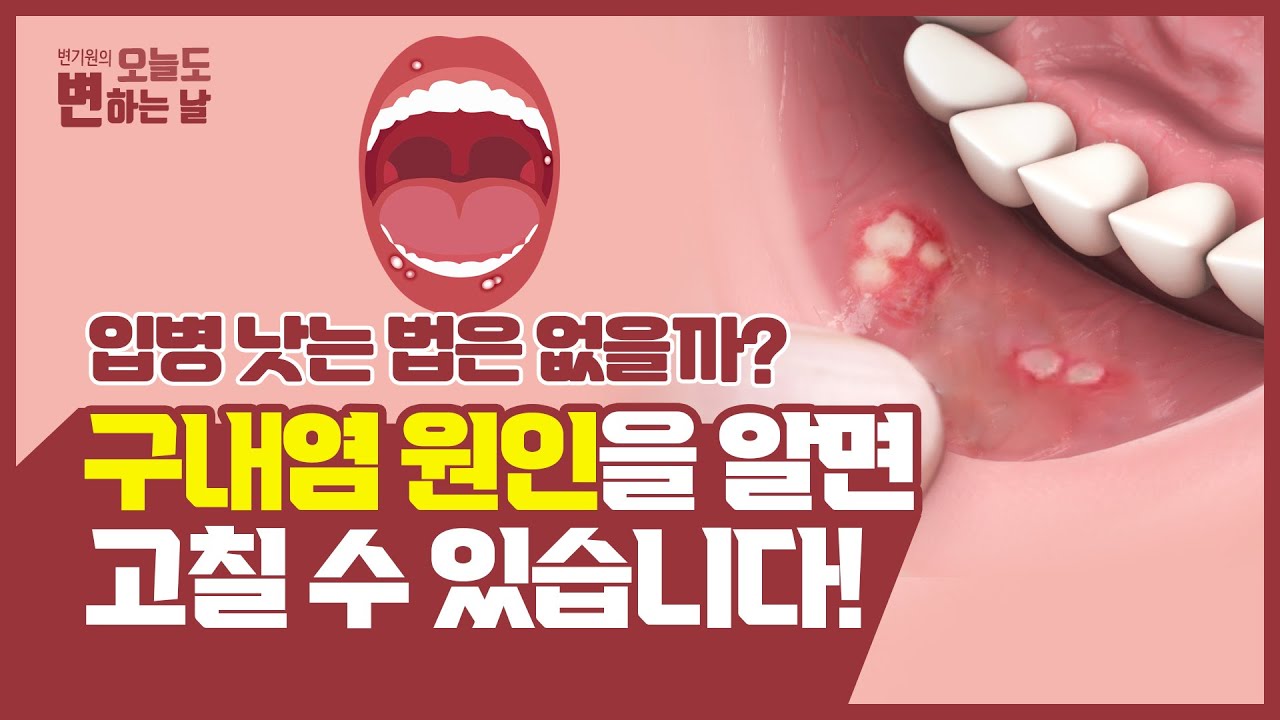 입병 낫는 법! 구내염 원인을 알면 고칠 수 있습니다! - YouTube