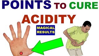 Sujok Therapy For Acidity||Gastritis||Acupressure Points For Acidity||Gastritis||In Hindi