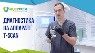 Диагностика на аппарате T Scan. 🖥  Выявление нарушения прикуса