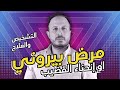 مرض بيروني التشخيص والعلاج مرض بيروني التشخيص والعلاج