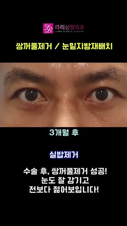 라리두잇 - Youtube