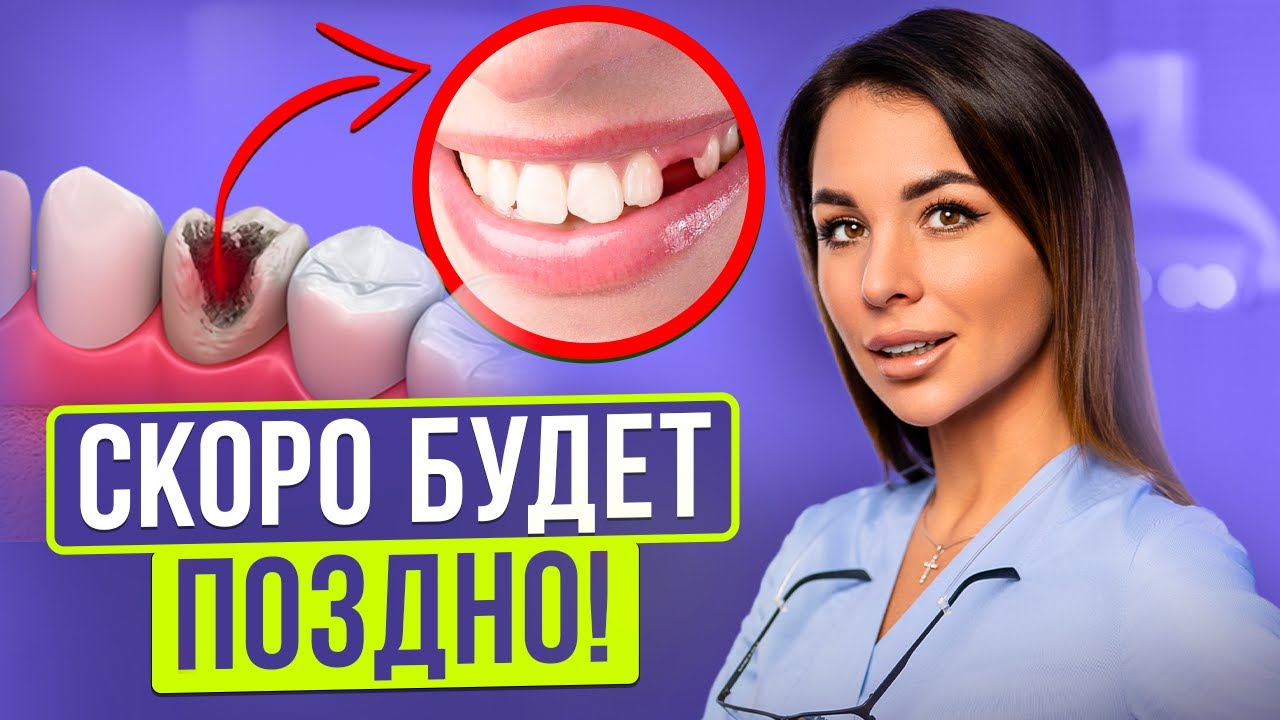 От кариеса до удаления зуба - один шаг. Как не допустить появление ...
