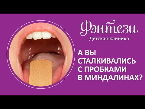 А вы сталкивались с пробками в миндалинах?😱Отоларинголог Некрасова Наталия #детскаяклиникамосква