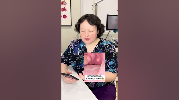 А вы сталкивались с пробками в миндалинах?😱Отоларинголог Некрасова Наталия #детскаяклиникамосква