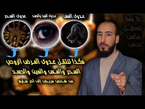 فيديو: هل يمكن أن تصاب بكدمة من شخص يمسك بك؟