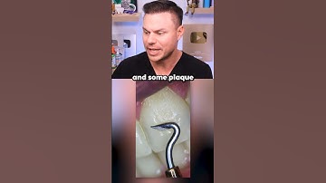 Your Teeth Under A Microscope! 🦷🔬