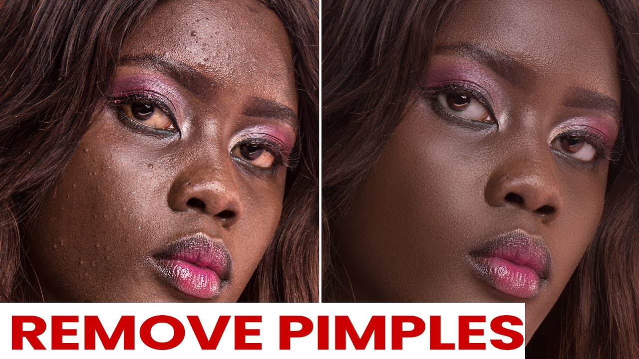 Get amazing skin textures in by removing pimples and
