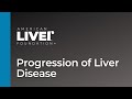 Progression of liver disease overview  animated