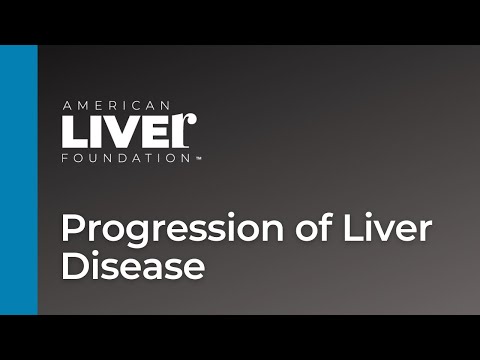 Progression of Liver Disease Overview - Animated
