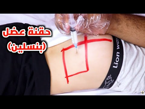 الطريقه الصحيحه لأعطاء حقنه البنسلين عضل مع عمل اختبار حساسيه_ intramuscular penicillin injection