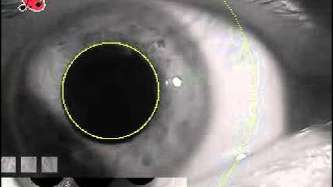 Human Iris Recognition for Identification