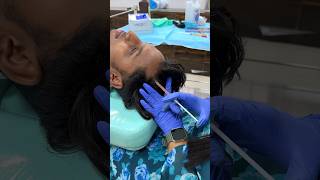 Hairfall 😢🤯one and only solution is in this video💯renew+ hair and skin clinic - 9150606660 #hair