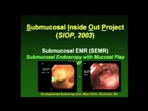 2010 Karl Storz Lecture: New Trends In Endoscopy
