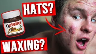 Does THIS Cause Acne? | Hats, Waxing, High Protein & More! (EP 5)